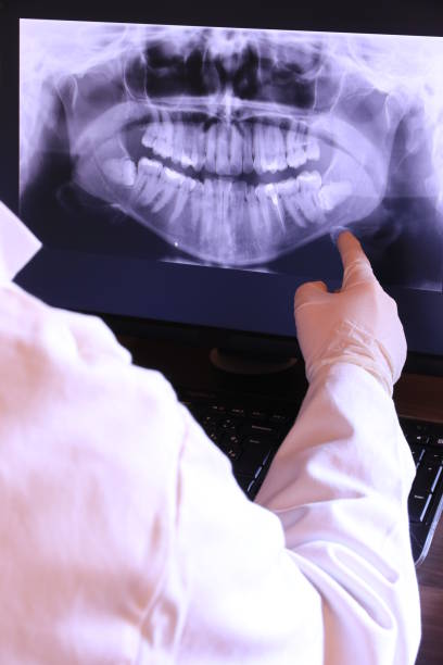 Emergency Dentist for Kids in IL