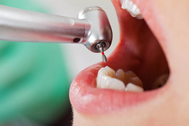 Best Tooth Infection Emergency Dentist  in Westlake Vlage, IL